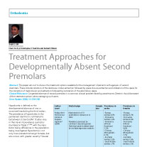 Managing missing second premolars