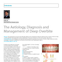 Deep overbite